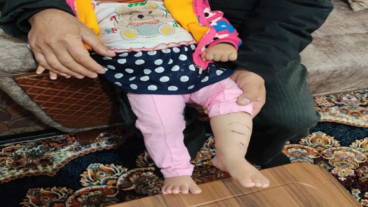 بیرون کشیدن کودک ۱۰ ماهه از دهان شغال در شهرستان درگزین