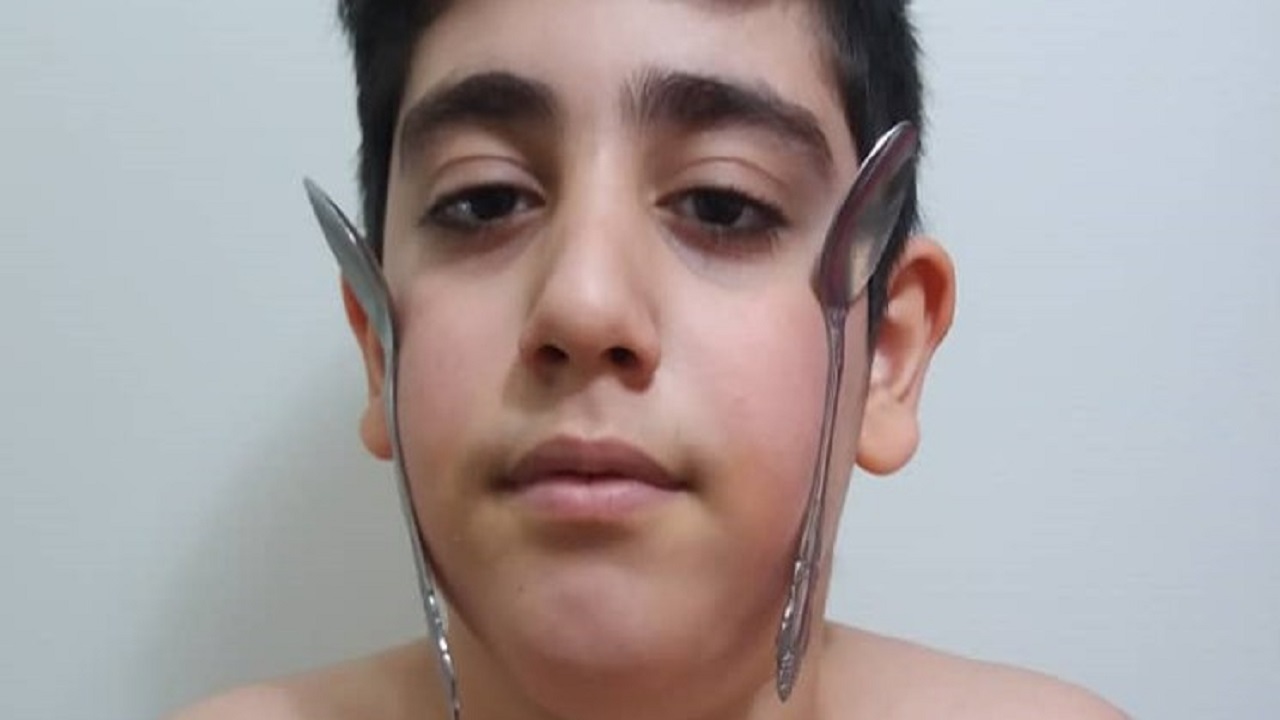 پسری که تمام اجسام آهنی را به خود جذب می‌کند + تصاویر