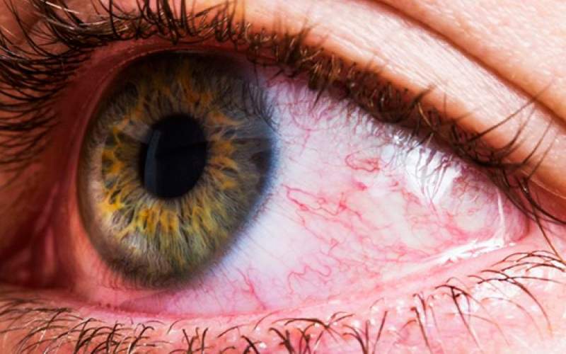 وقتی رنگ های مصنوعی جلوه رنگ خدا را کمرنگ می کنند