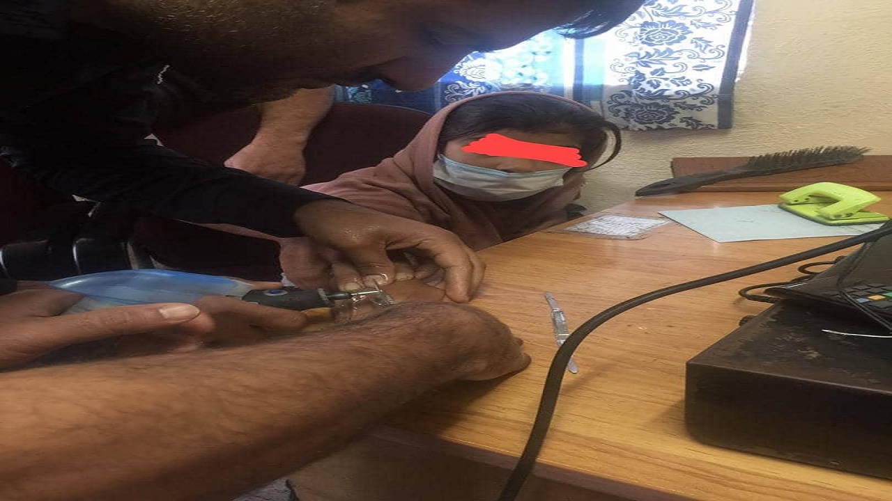 گیرکردن حلقه انگشتری در انگشت دختر خردسال خرمشهری
