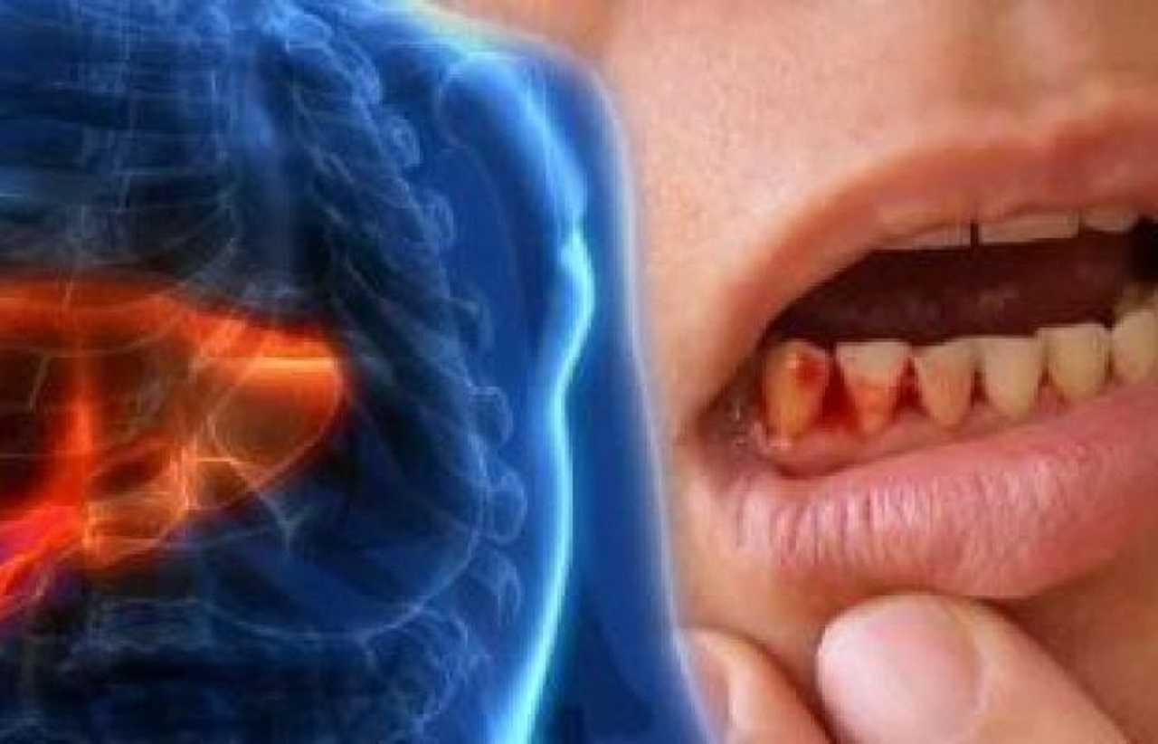 علائم کبد چرب و راه‌های پیشگیری از آن