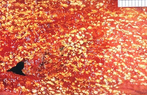 ۱۰ اصطلاح خوشمزه پزشکی + تصاویر