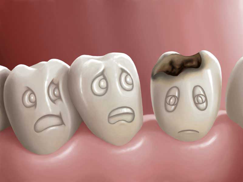علت پوسیدگی دندان از داخل چیست؟