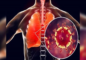 آثار کرونا برای همیشه در دستگاه تنفسی بیمار باقی می‌ماند؟ + فیلم
