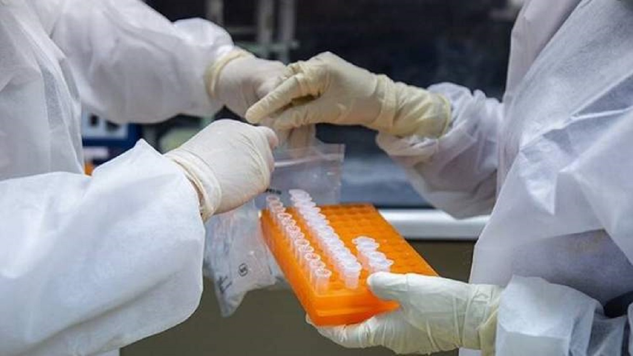 انجام روزانه ۸۰ آزمایش PCR در چهارمحال و بختیاری