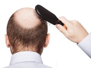 شامپو‌های ضدریزش مو ترفند تبلیغاتی هستند