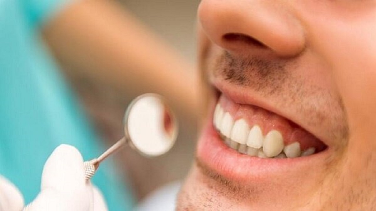 آیا جرم گیری برای دندان‌ها ضرر دارد؟