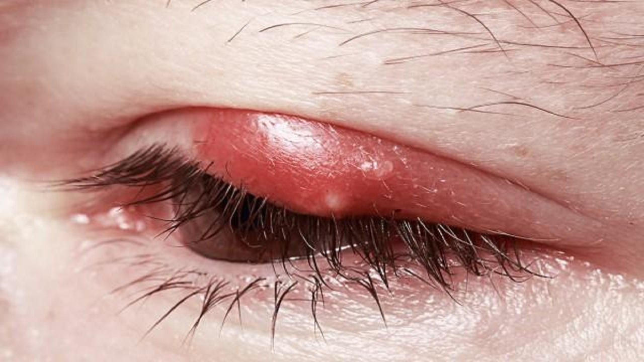 چرا گل‌مژه می‌زنیم؟