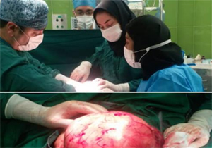 خارج کردن توده ۵ کیلویی از شکم دختر بچه ۹ ساله