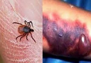 هشدار در مورد شیوع بیماری تب کریمه کنگو در فصل گرما