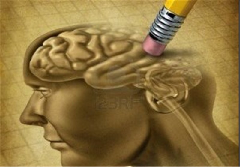 زوال عقل زوال عقل