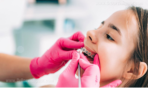 مسواک ارتودنسی را چند بخریم؟