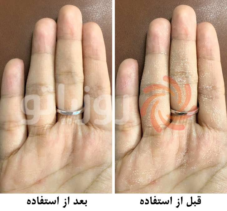 رفع خشکی پوست دست با پنج راهکار بسیار ساده رفع خشکی پوست دست با پنج راهکار بسیار ساده
