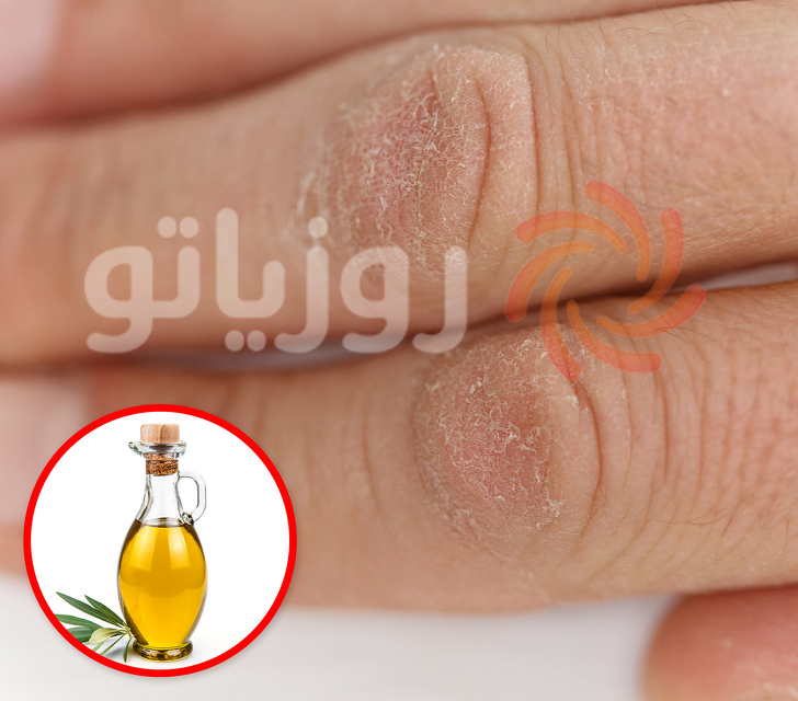 رفع خشکی پوست دست با پنج راهکار بسیار ساده رفع خشکی پوست دست با پنج راهکار بسیار ساده