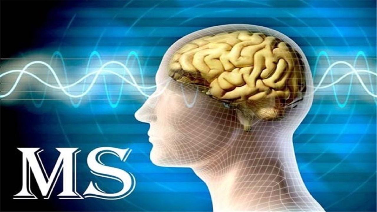 صادرات داروهای ام‌اس ایرانی به روسیه/ احتمال شیوع بیماری در کودکان کم است