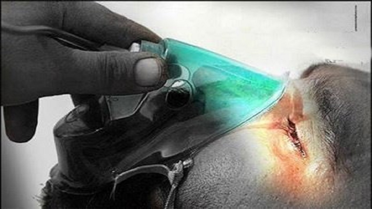 تاریخچه استفاده از سلاح‌های شیمیایی در جنگ‌ها به ویژه رژیم بعثی عراق در جنگ تحمیلی