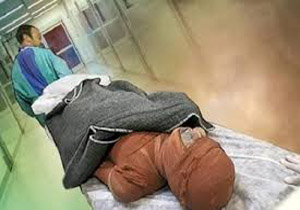 اشغال ۵۰ درصدی تخت  در  بخش سوختگی  دانشگاه علوم پزشکی خراسان شمالی