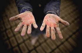 بسته‌های حمایتی بین کودکان کار توزیع شد