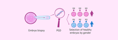 آیا به دنبال راهی برای تعیین جنسیت جنین خود، پیش از بارداری هستید؟!