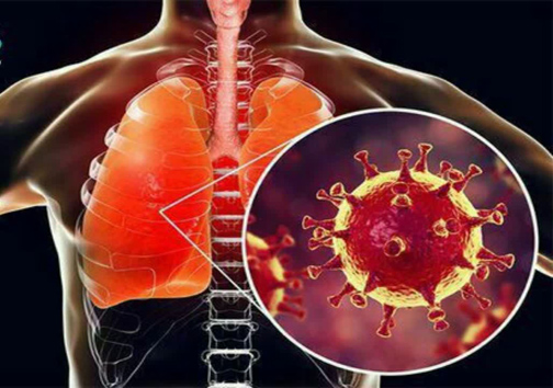 دانستنی&zwnj;های ضروری برای همگان درباره بیماری ناشی از کرونا ویروس جدید