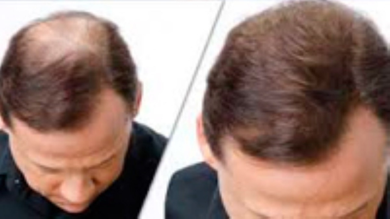 ۴ میوه مغذی و مفید برای رشد مو