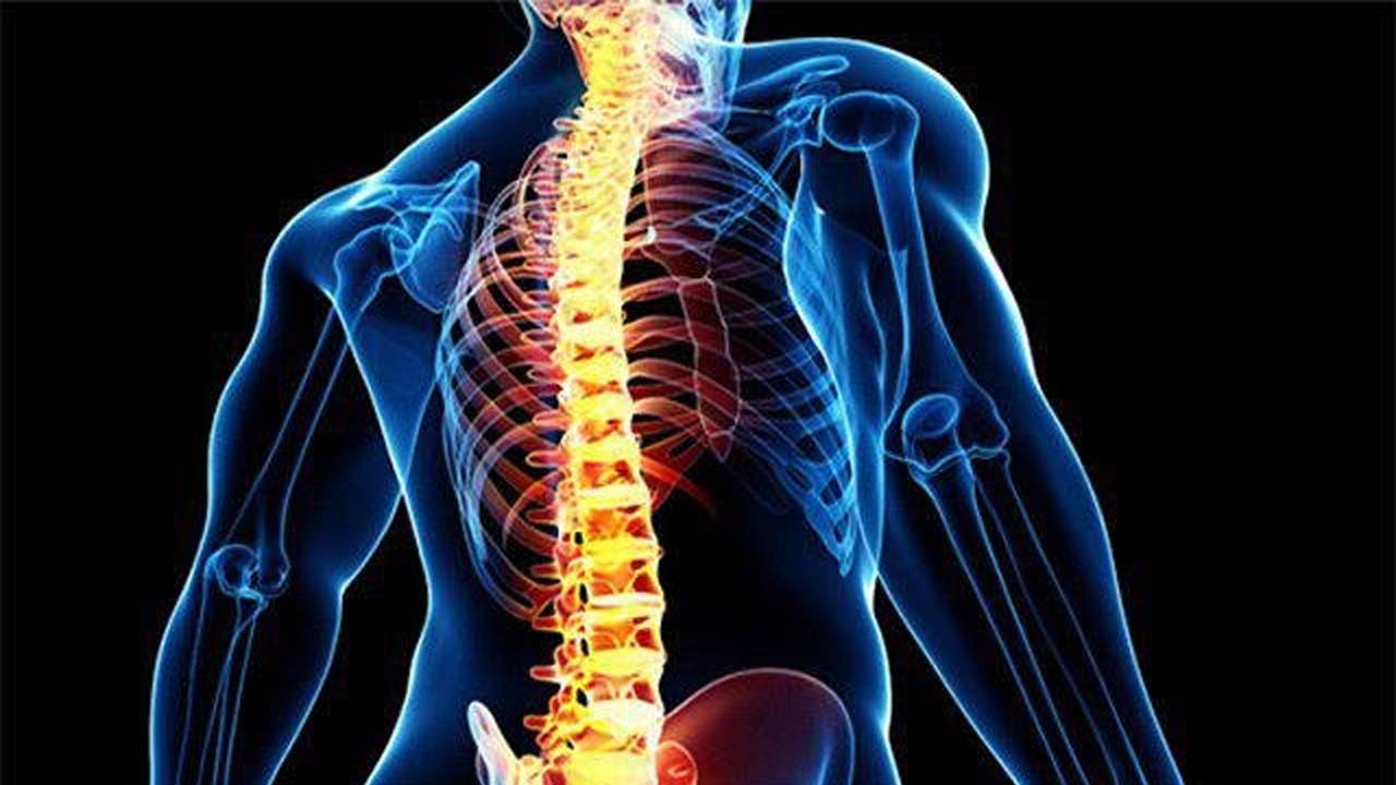 علل و عوارض پشت صاف + حرکات اصلاحی