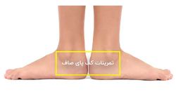 عارضه کف پای صاف بیشتر در چه سنینی دیده می‌شود؟ + فیلم