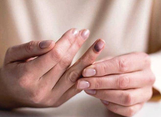 تست&zwnj;های جالب سلامتی/ در ۳۰ ثانیه از سلامت بدن خود باخبر شوید!