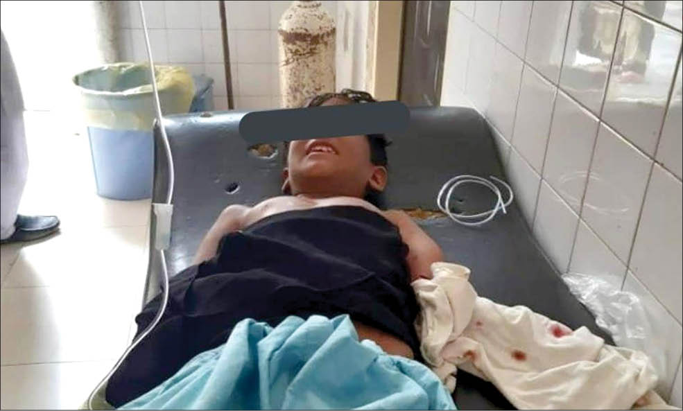 &laquo;گاندو&raquo; دست پسر&zwnj;بچه چابهاری را خورد + عکس