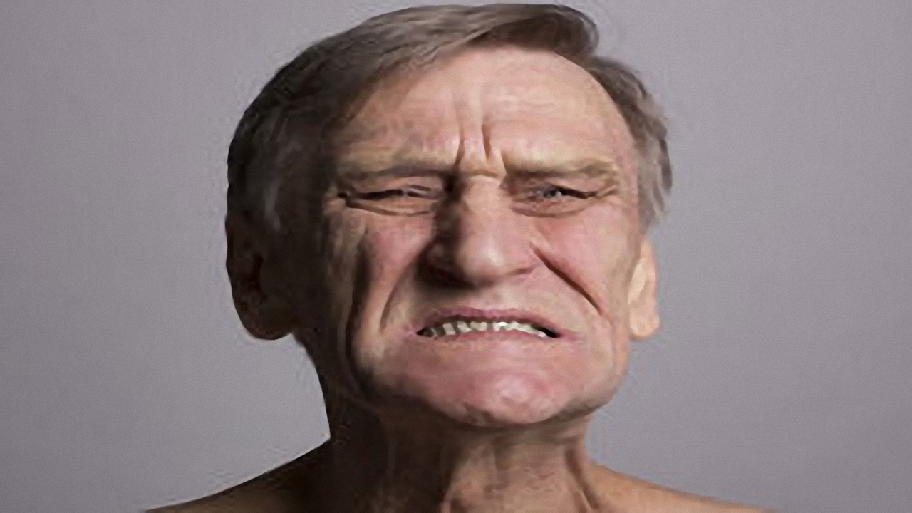 علل، علایم و درمان سندرم تورت