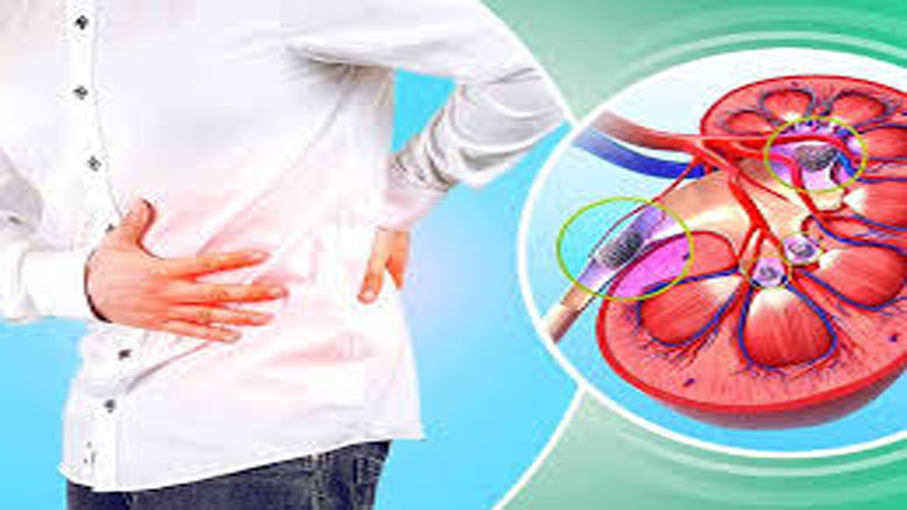 چرا خطر سنگ کلیه با افزایش دما به‌ ویژه در تابستان بیشتر می‌شود؟