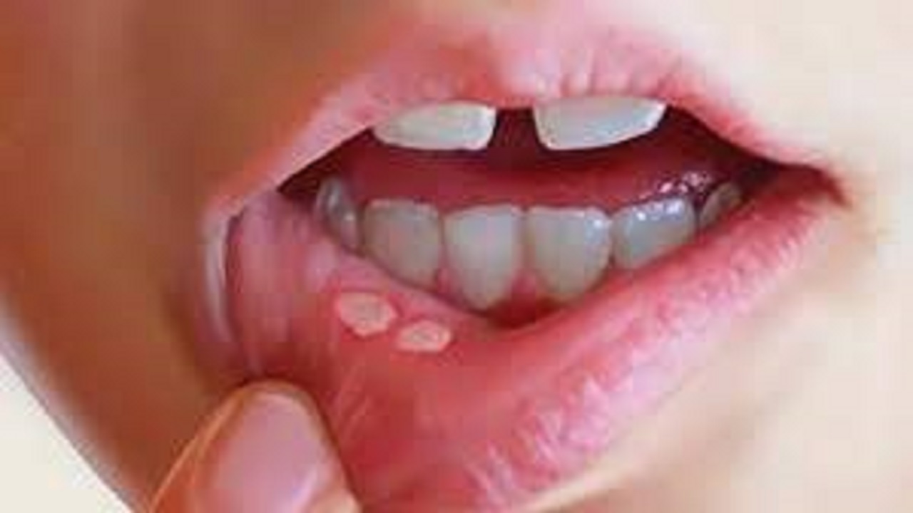 تغییر در حفره دهانی را باید جدی گرفت