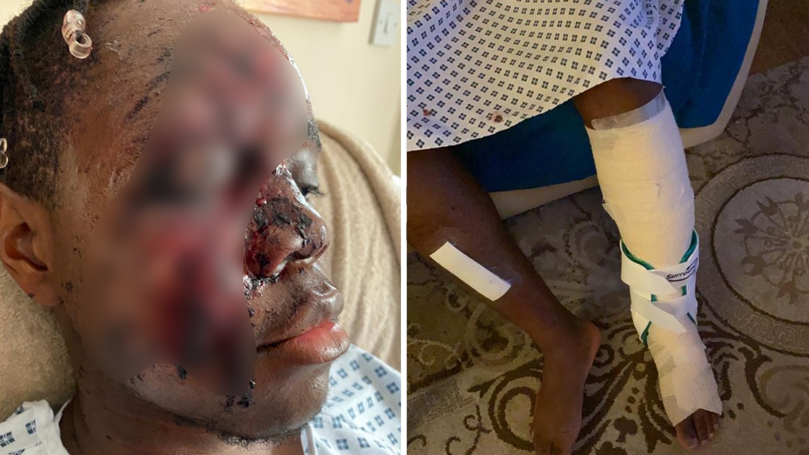 حمله نژادپرستانه به یک جوان سیاه&zwnj;پوست در انگلیس