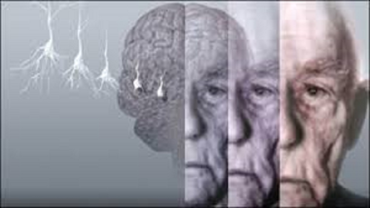 هورمون عشق امیدی برای درمان آلزایمر