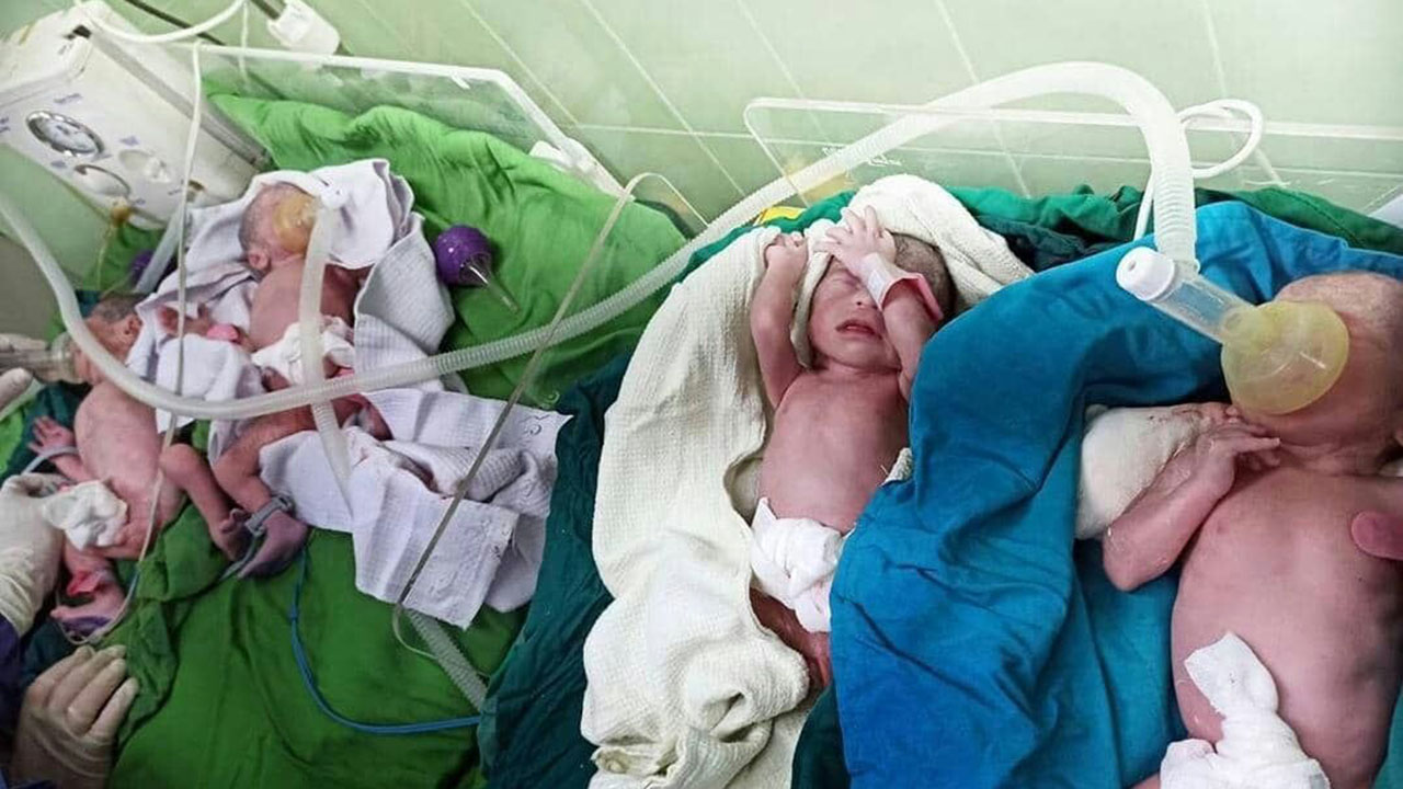 تولد چهار قلو‌ها در گرگان