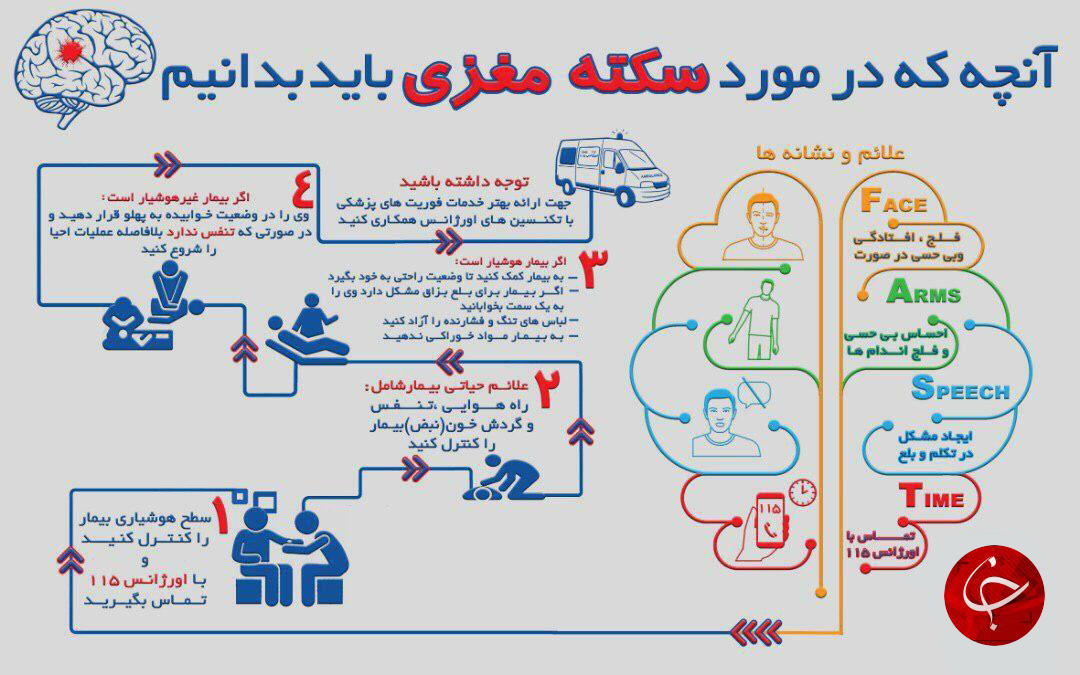 آنچه که در مورد سکته مغزی باید بدانیم آنچه که در مورد سکته مغزی باید بدانیم