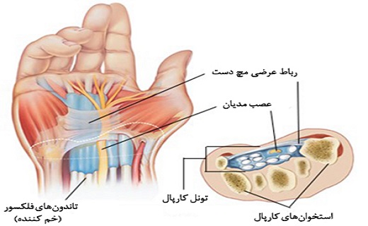 ساختار تونل کارپال 