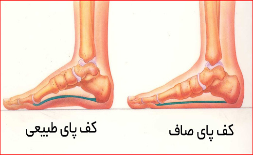 قصه الماس سیاه/ مادرانه های بی بی مروارید/ زندگی پشت چراغ های قرمز شهر