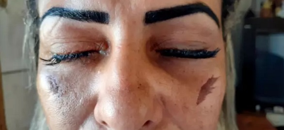از دست دادی بینایی زنی که در جستجوی زیبایی بود