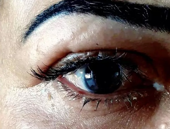 از دست دادی بینایی زنی که در جستجوی زیبایی بود