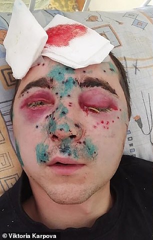 شکار دردسرساز