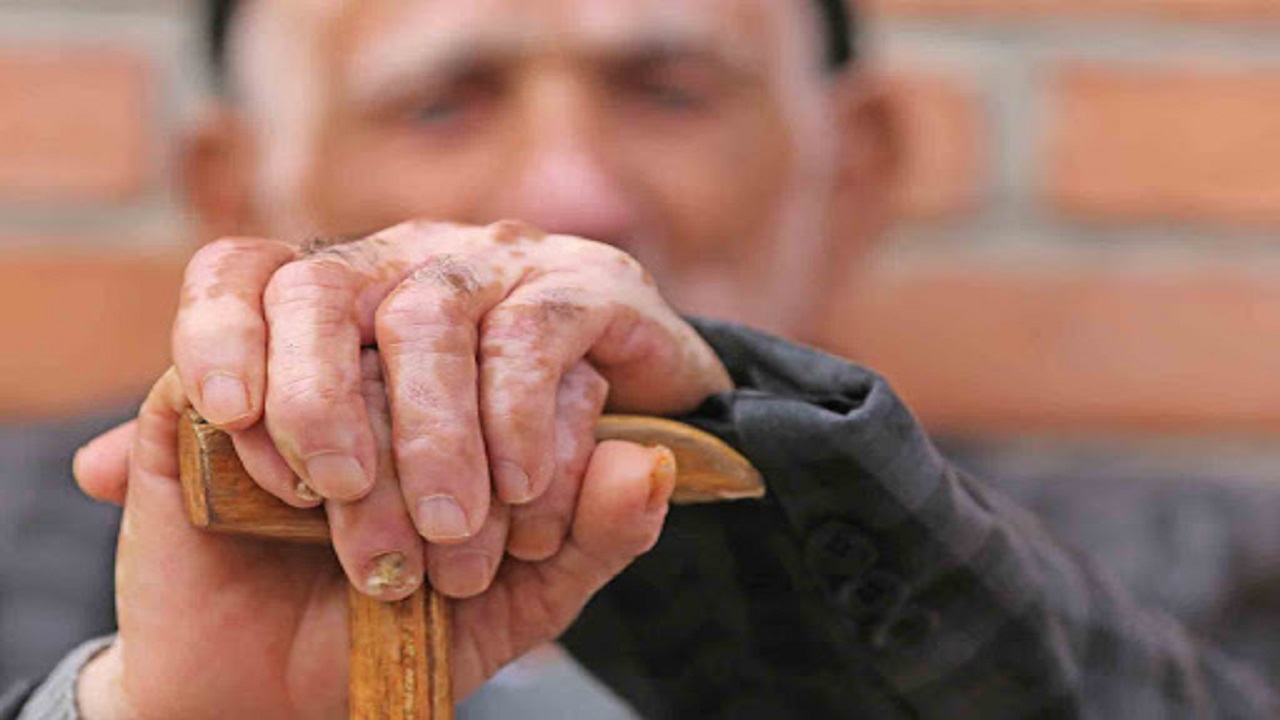 افسردگی شایع‌ترین بیماری روحی سالمندان