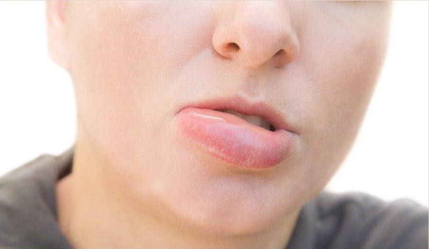 عکس ها کامل شود/ مهم&zwnj;ترین سندرم&zwnj;های جهان که باید با آن&zwnj;ها آشنا شوید
