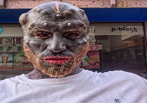عمل جراحی عجیب از جوان ۳۲ ساله موجودی شبیه هیولای فضایی ساخت + عکس