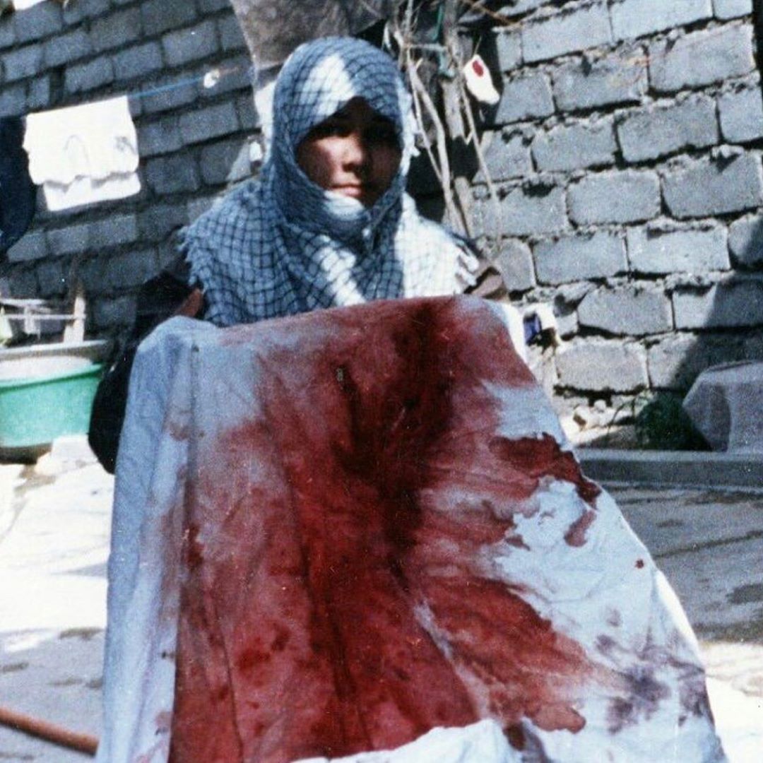 جنگ چهره&zwnj;ی زنانه هم دارد + عکس