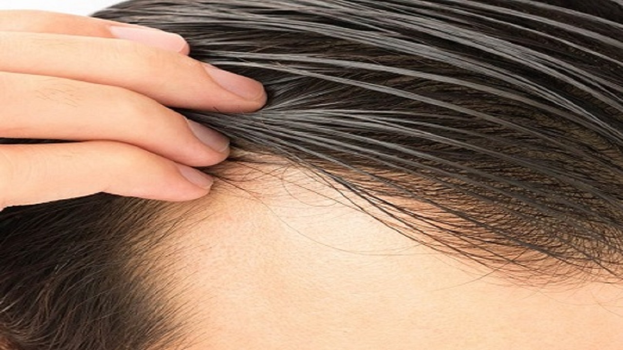 چطور چربی پوست سر را کم کنیم؟