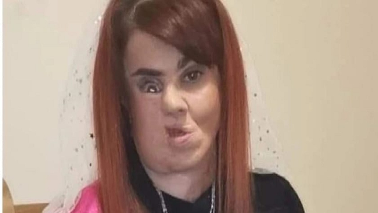 برخورد زننده مهمانان با عروس به خاطر چهره‌اش + عکس