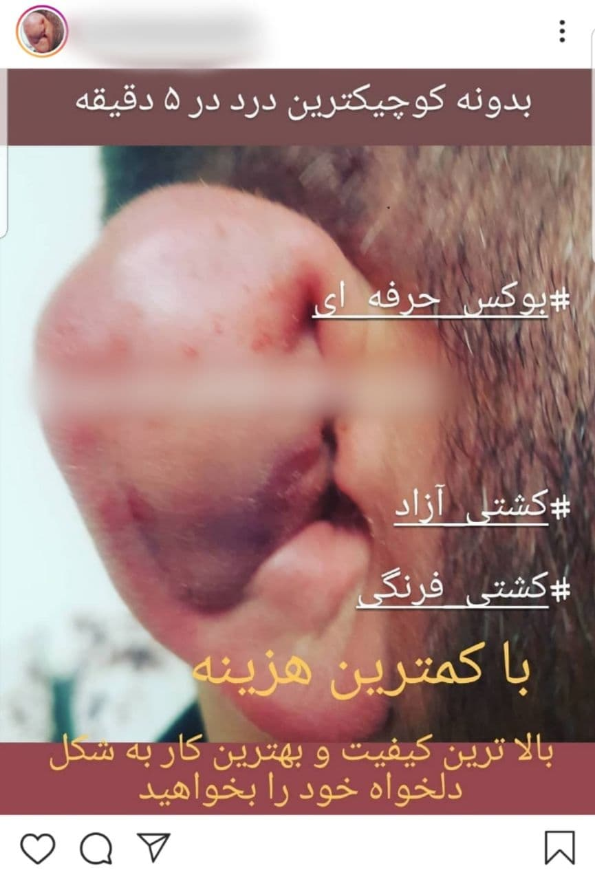 کشتی آزاد و فرنگی با کمترین هزینه؛ فقط با ۲۵۰ هزار تومان کشتی گیر شوید! + تصاویر