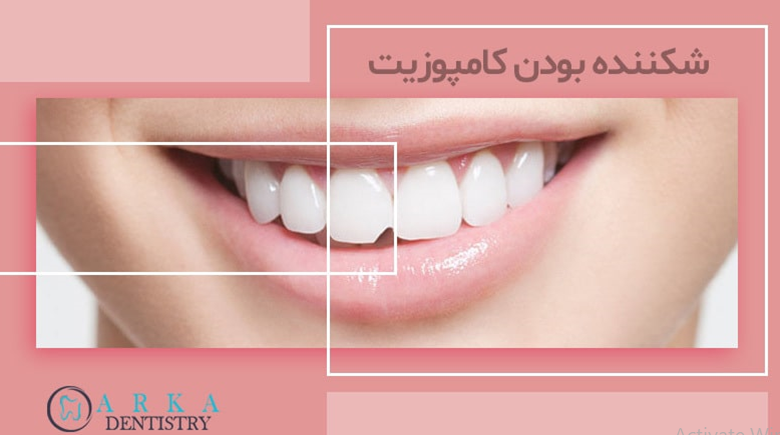 کامپوزیت دندان چیست؛ با مزایا و معایب آن آشنا شوید