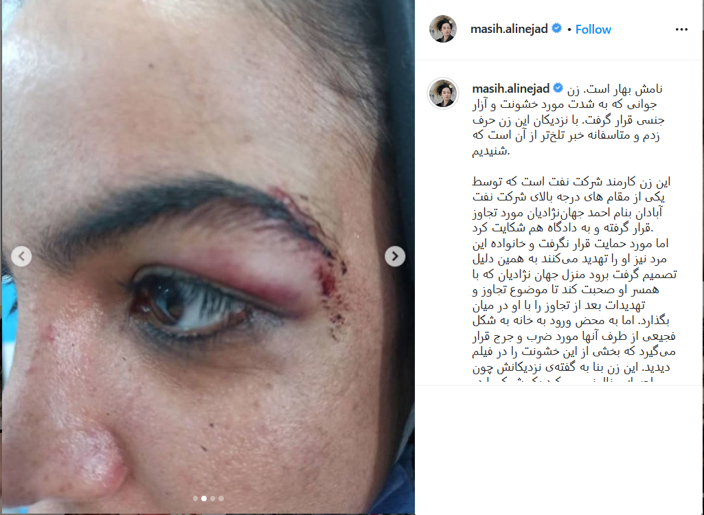 واکنش رسانههای معاند به ماجرای دختر اسیدپاش روایت اشتباه رسانههای معاند از ماجرای دختر اسید پاش در آبادان